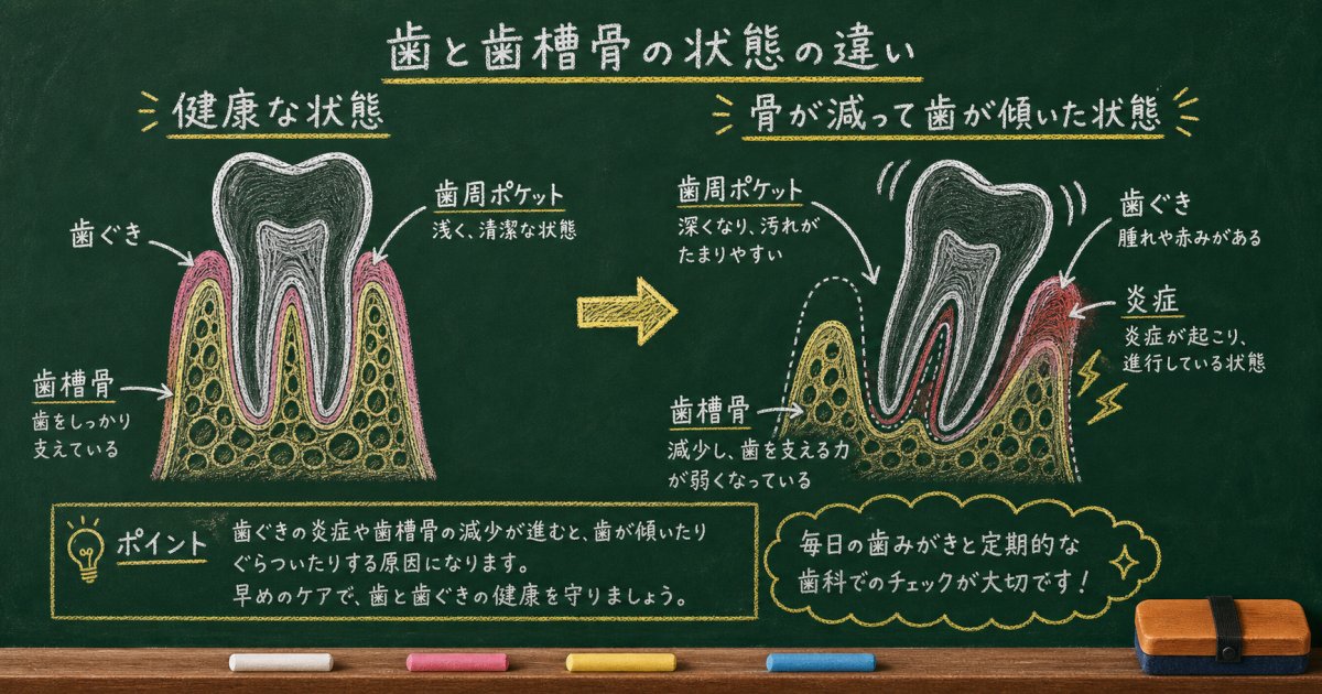歯がグラグラ揺れる主な原因と歯周病の仕組み