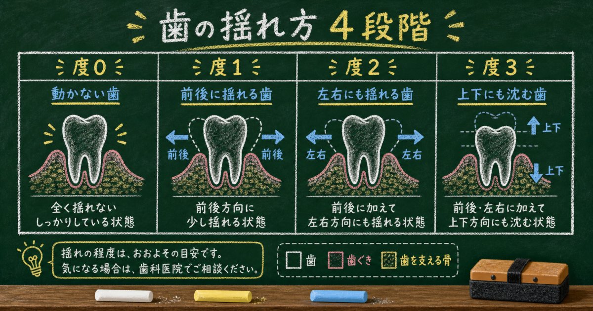 歯周病の進行度別に見る症状と歯のグラつきレベル