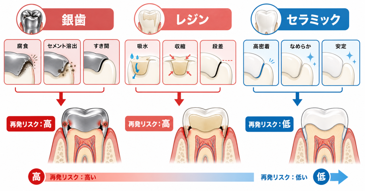 ■銀歯やレジンでむし歯が再発しやすい理由