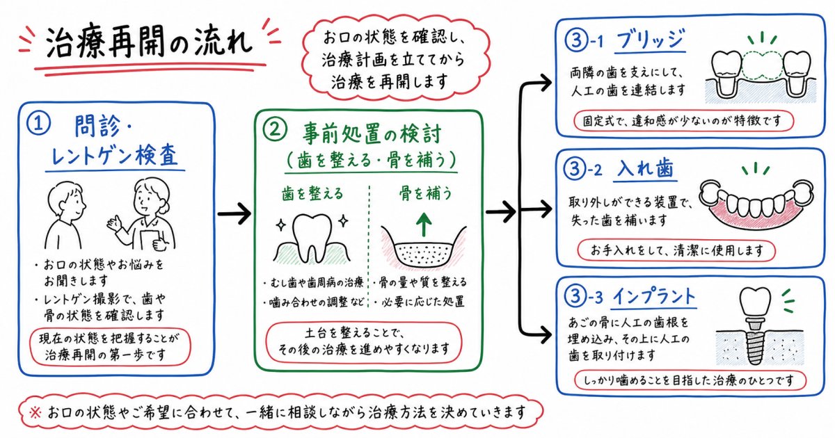 抜歯後数ヶ月放置した際のお口の変化と生じる影響