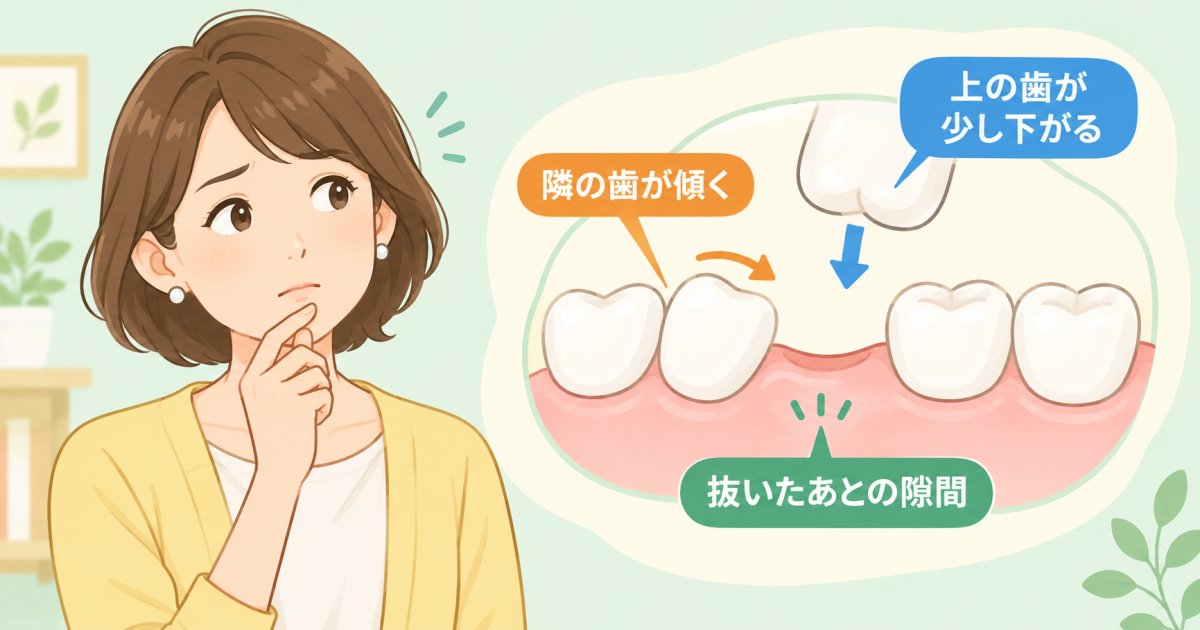 奥歯を抜歯後に半年放置した場合の影響と噛み合わせへのリスク