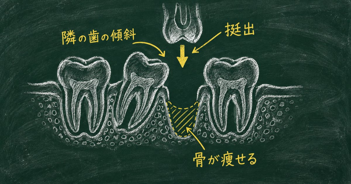 奥歯を半年放置した口の中で起きている変化の仕組み
