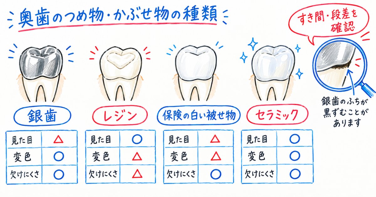 接客時の見え方・変色で銀歯と白い歯はどう違う?