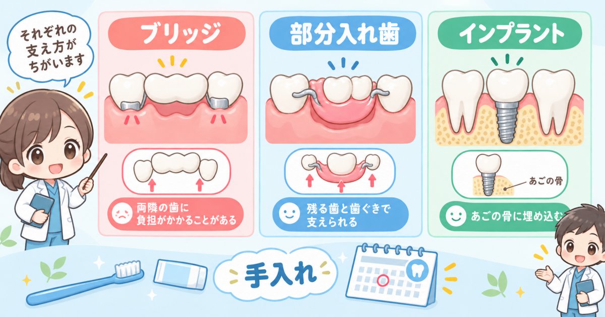 歯を失ったときの治療選択肢は3つ！費用や残る歯への影響から考える選び方